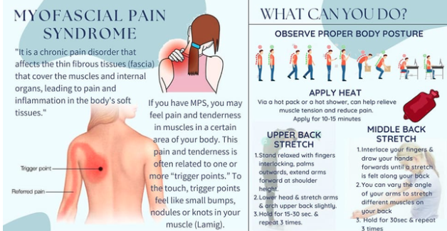 Areas Commonly Affected by Myofascial Pain