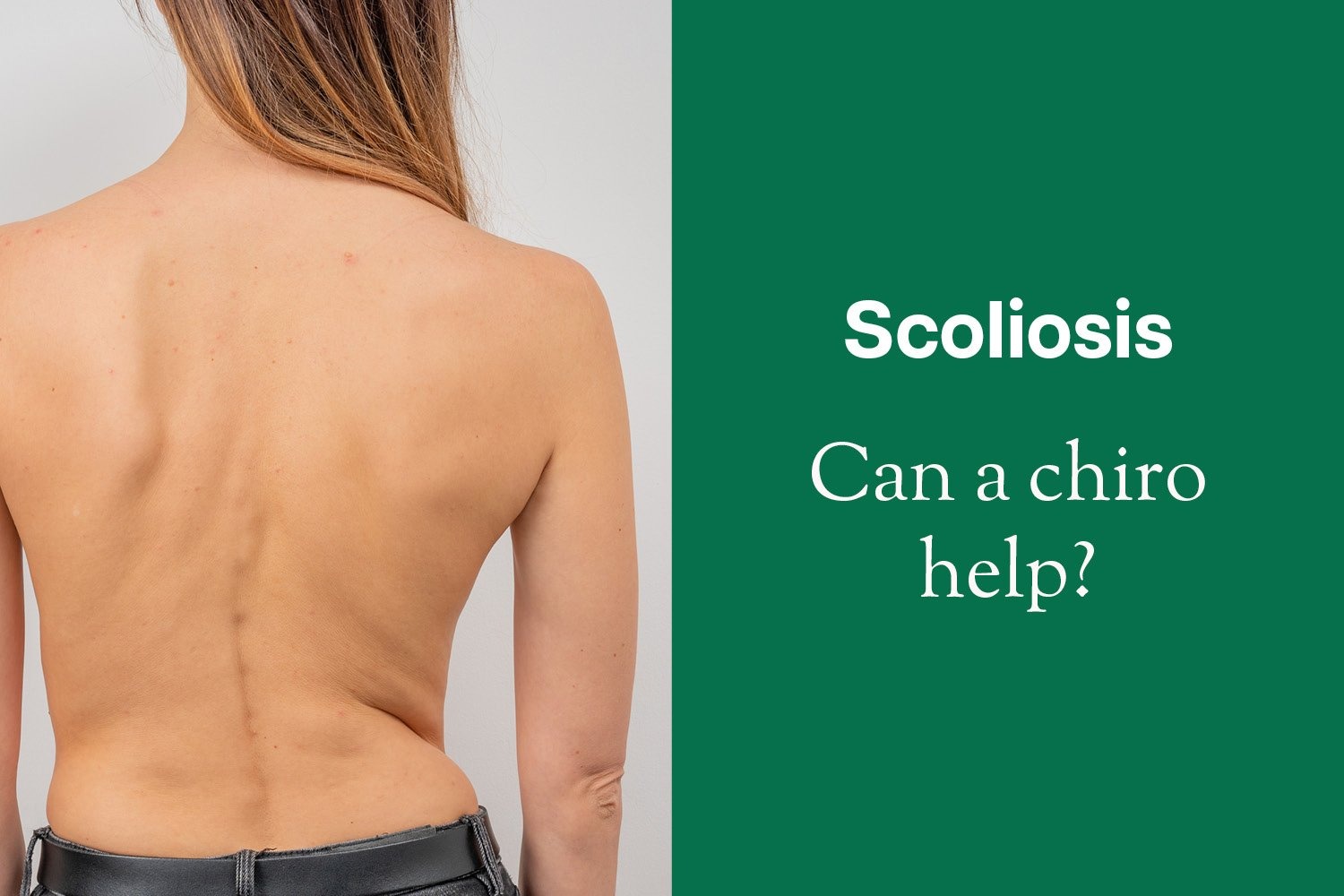 Can a Chiropractor Treat Scoliosis?
