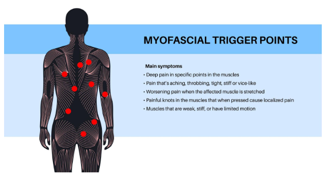 Is There a Myofascial Release Therapist Near Me in Portland, Oregon?