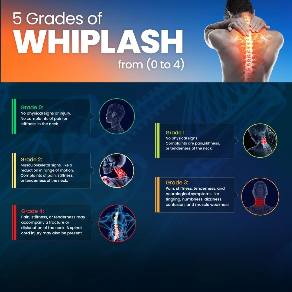 Understanding Whiplash Grading: How It Affects Your Chiropractic Care in Portland, Oregon