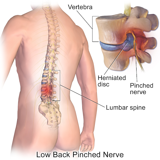 Can a Minor Car Accident Cause Damage to the Neck and Spine?
