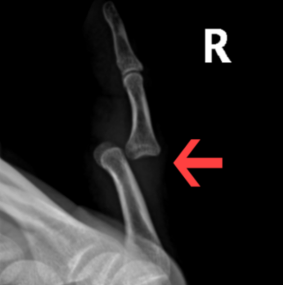 treat-dislocated-joints-portland